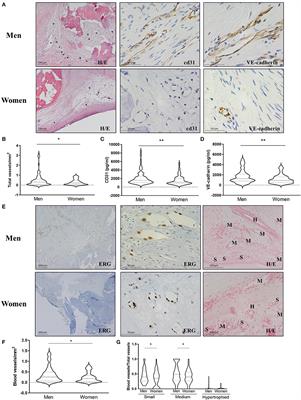 Characterization of the sex-specific pattern of angiogenesis and lymphangiogenesis in aortic stenosis